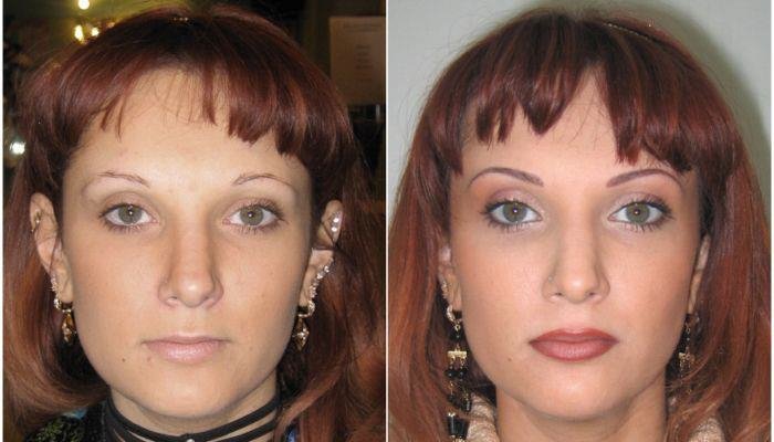 Semi-Permanent Make-Up Before And After, Body Silk Clinic, London